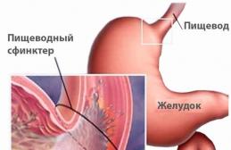 Несварение кишечника симптомы лечение